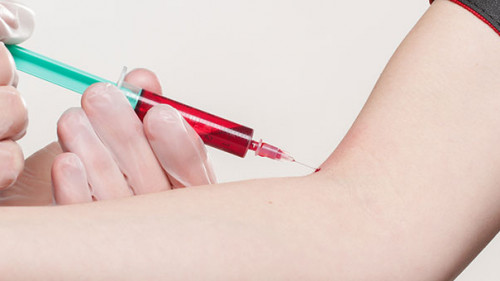 Blutentnahme-2722940-PB-whitesession