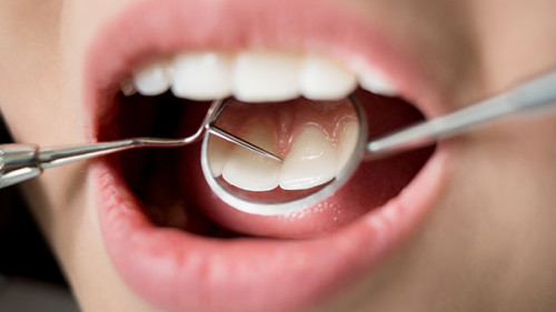 Zahnarzt-163337638-AS-anatoliy-gleb