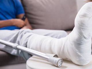 Mann-Gipsbein-190685104-AS-Andrey-Popov