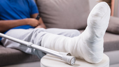 Mann-Gipsbein-190685104-AS-Andrey-Popov