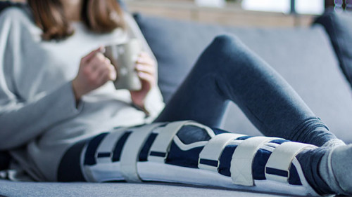 Frau-Gips-Couch-301953442-AS-Monstar-Studio