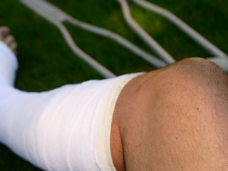 Bein-Gips-Kruecken-308085929-AS-Reimar