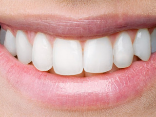 Laecheln-310076806-AS-BillionPhotos-com