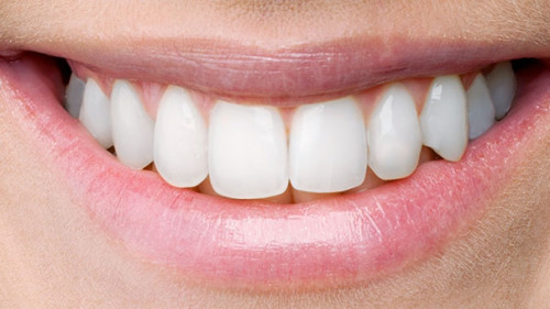 Laecheln-310076806-AS-BillionPhotos-com