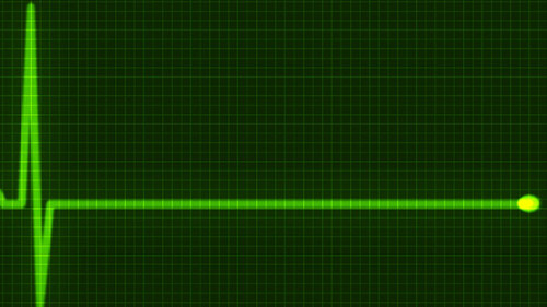 Herzschlag-32548761-AS-Buriy