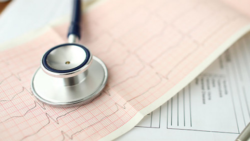 Stethoskop-EKG-295876075-AS-megaflopp