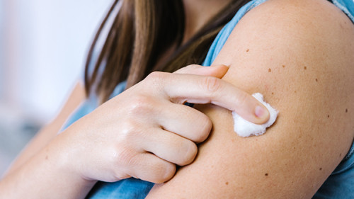 Frau-nach-Impfung-393122790-AS-Guillem-de-Balanzó