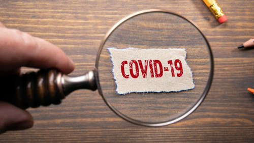 COVID-19-Lupe-326117496-AS-STOATPHOTO