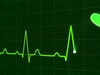 EKG-Herz-163709-AS-PublicDomainPictures