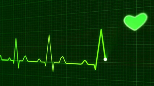 EKG-Herz-163709-AS-PublicDomainPictures