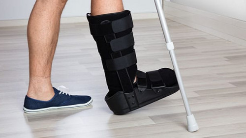 Low Section View Of An Injured Person's Leg