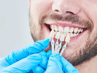 dentistry. matching colour of the tooth enamel with whitening chart
