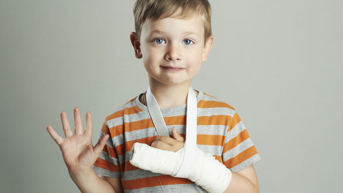 little boy in a cast.child with a broken arm.after accident