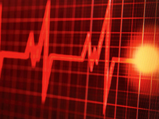 Photo taken of a heartbeat on the monitor