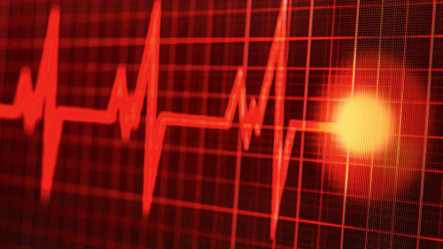 Photo taken of a heartbeat on the monitor