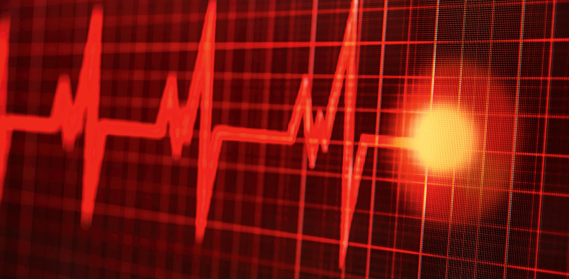 Photo taken of a heartbeat on the monitor