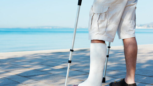 MannGipsBeinStrand-51759678-FO-contrastwerkstatt