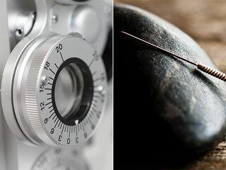 Phoropter-Akupunktur-Nadel-101712900-47108003-FO-erllre-hjschneider