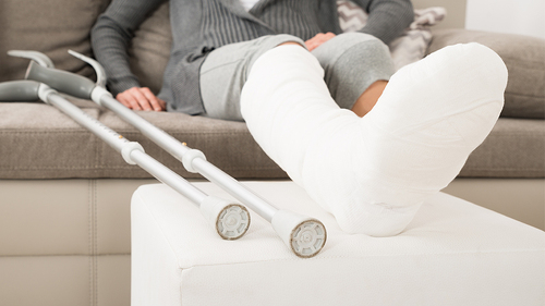 Frau-Sofa-Gips-Kruecken-112349961-FO-Andrey-Popov