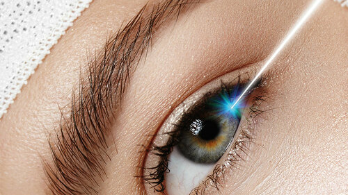 augen-op-66787325-fo-anastasiia-kazakova