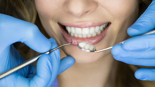 Frau-beim-Zahnarzt-100506526-FO-Andriy-Bezuglov