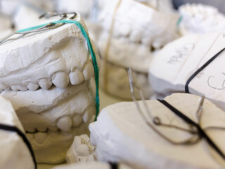 Gebiss-Modelle-797308-PB-Humusak