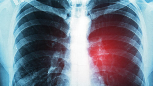 Roentgenbild-170353681-FO-Africa-Studio