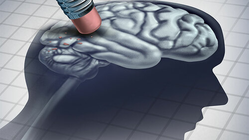 Radierer-loescht-Hirn-165487873-FO-freshidea