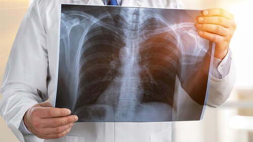 Arzt-Roentgenbild-219880948-FO-BillionPhotos-com