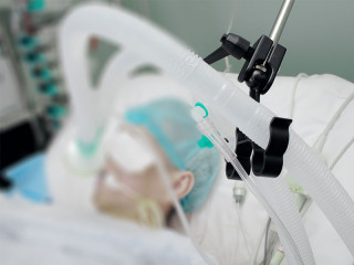 Patient-Koma-83512078-FO-sudok1