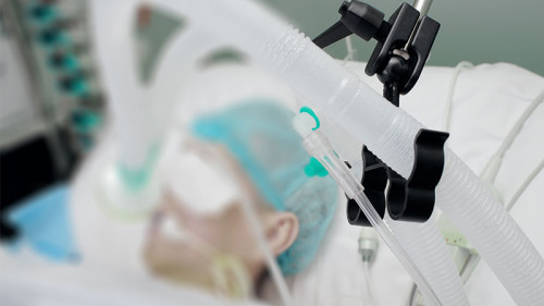 Patient-Koma-83512078-FO-sudok1